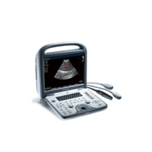 Animal Veterinary Ultrasound B/W Black White Doppler Laptop Veterinary (A6V)